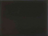 16- Bone plate